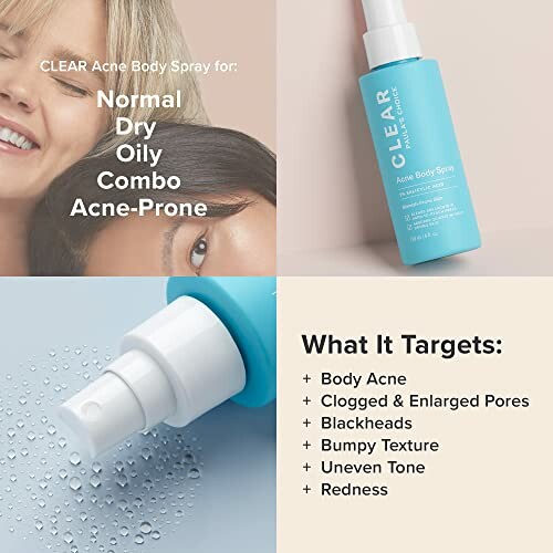 Clear acne body spray for various skin types and issues, including a product bottle and target areas.