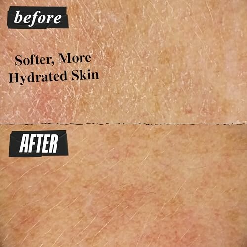 Comparison of skin texture before and after hydration treatment.