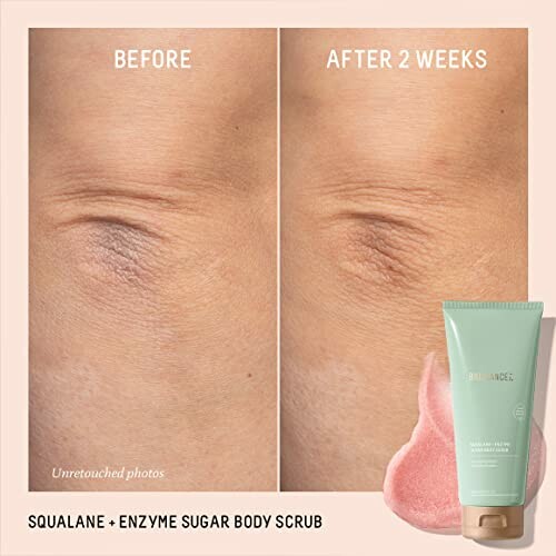 Before and after 2 weeks of using squalane enzyme sugar body scrub on skin